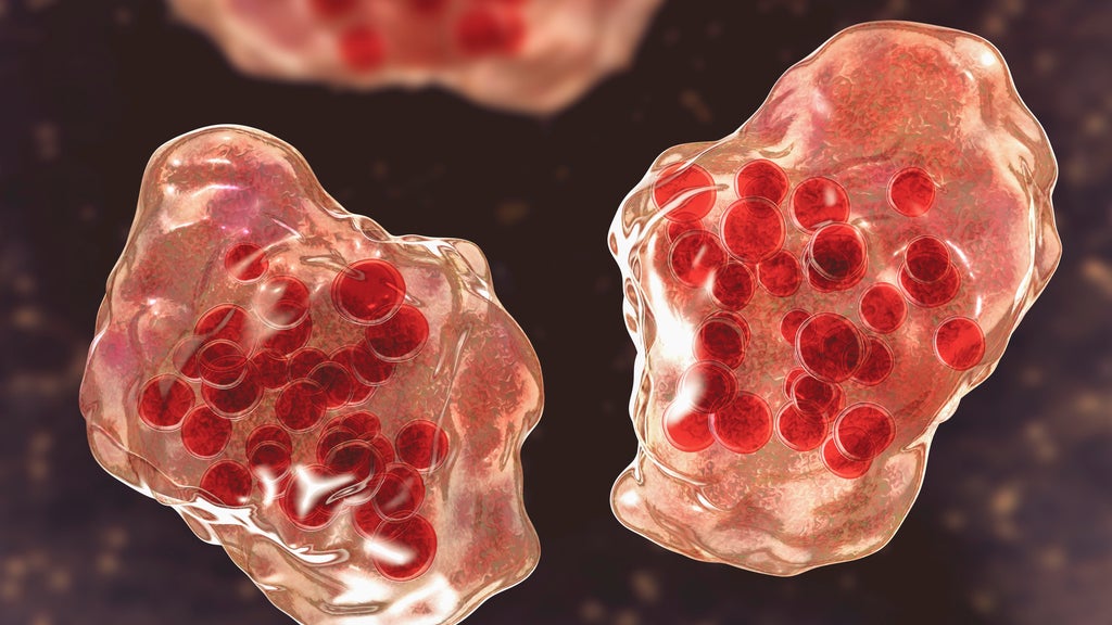 Central Minnesota county reports "several cases of suspected measles" — WCCO / CBS Minnesota, St. Louis Park Health news