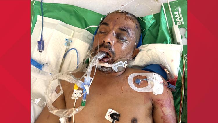 University Hospital asks for help identifying unconscious patient hit by truck Saturday evening — KENS 5 (San Antonio), St. Louis Park Health news