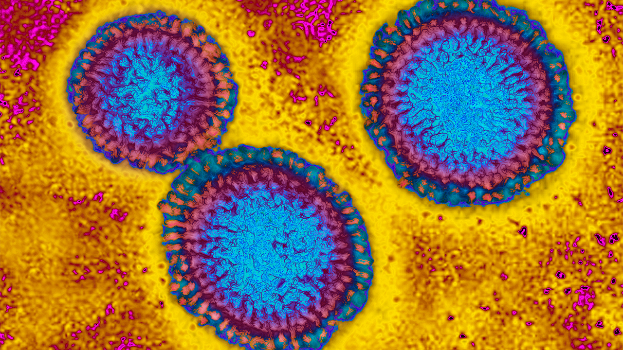 Flu hospitalizations 'slightly higher' than usual, officials urge vaccinations — FOX 9, St. Louis Park Health news